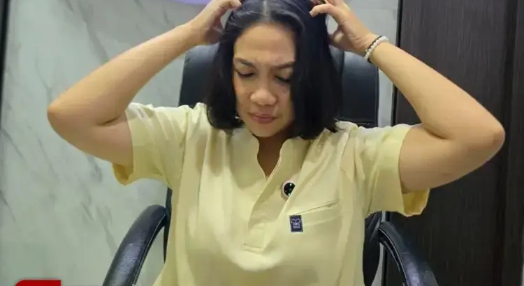 Bekas Jerawat Merah dan Hitam, Kenapa Hilangnya Berbeda-beda? Ini Penjelasan Dokter Dhelya